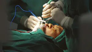 Supernumerary Nostril with Medial Eyelid Coloboma: A Rare Congenital Nasofacial Anomaly – A Case Report