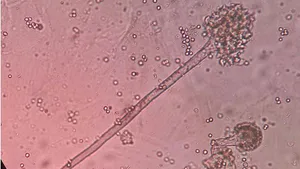 Isolation of  with Rugose Spiralling Whitefly, Aleurodicusrugioperculatus Martin in Different Host Crops