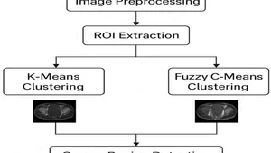 A Machine Learning Assisted MRI Approach for Early Detection of Pelvic Bone Cancer