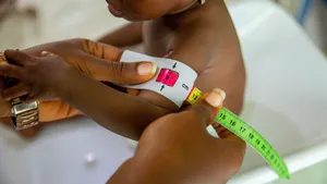 Dietary Habits and Nutritional Status of Hemodialysis Patients Seen in Some Hemodialysis Centers in Lomé