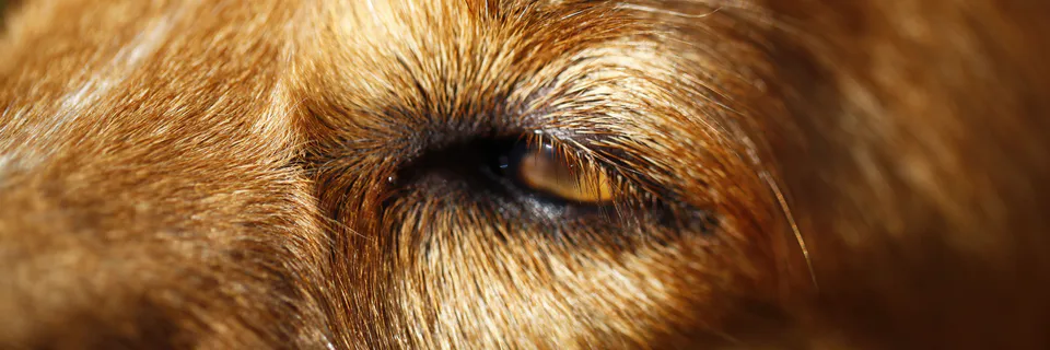 An Undiagnosed Case of Systemic Lupus Erythematosus Presenting with Diminution of Vision