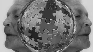 Clinical Improvement in a Patient with Parkinsonism and Vascular Dementia Receiving PCSK9 Inhibitor for Ischemic Heart Disease: A Case Report