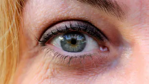 Prevalence and Corneal Morphometry of Pediatric Keratoconus: A Two-Year Cross-Sectional Study in Ukraine