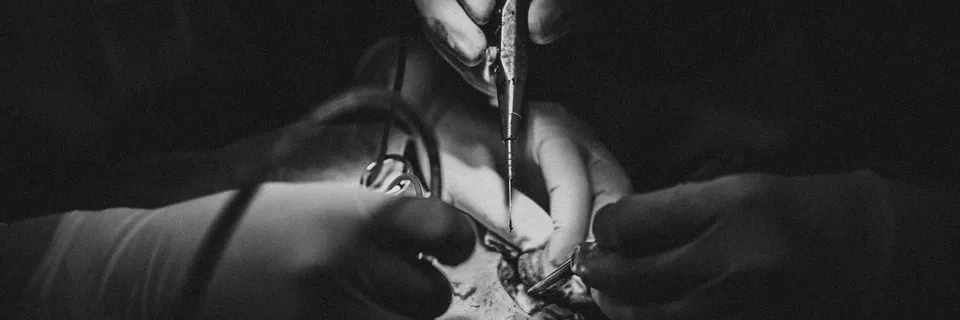 Extracranial Meningioma: Case Report and Challenges