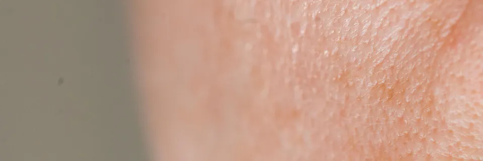 Recombinant Enzymes for Cellulite Treatment