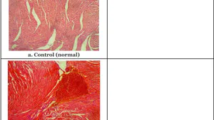 Toxicological Studies of Picralima Nitida Aqueous and Ethanolic Extracts in Animal Model