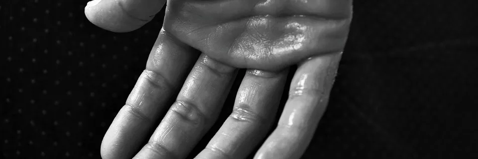 Narcolepsy: The Tip of an Iceberg  of Neurological Dysfunction