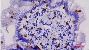 Canine Chronic Inflammatory Enteropathy with Special Reference to Immunological Markers for Diagnosis