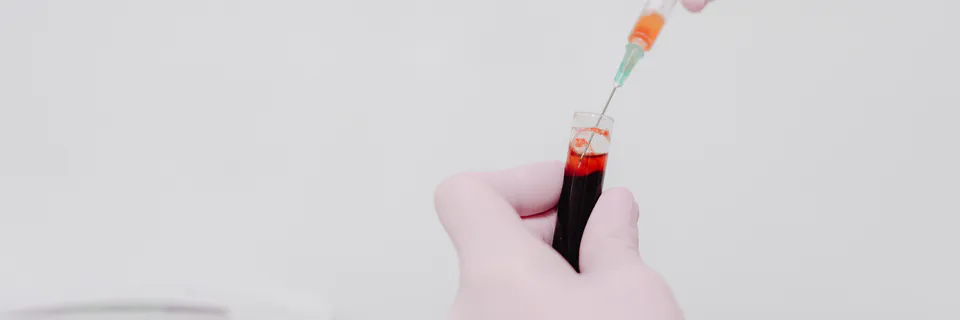 Effect of BioLife-Regen Device on Triglycerides and Lipids